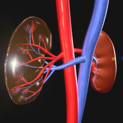 Magas vérnyomás és veseartér szűkület