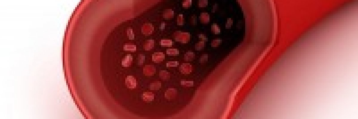Nagyobb odafigyelést igényel a cukorbetegeknél az érszűkület szűrés