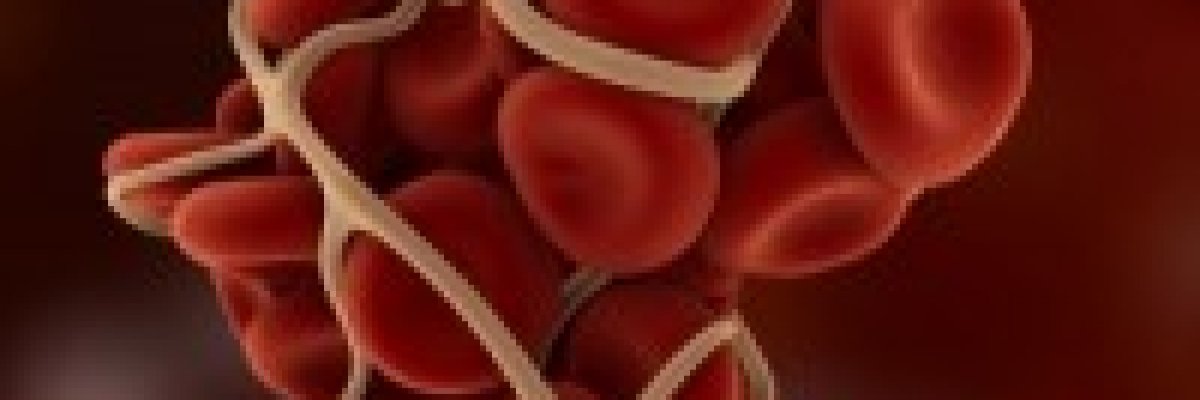 Ezekre figyeljen műtét előtt, ha véralvadásgátlót szed