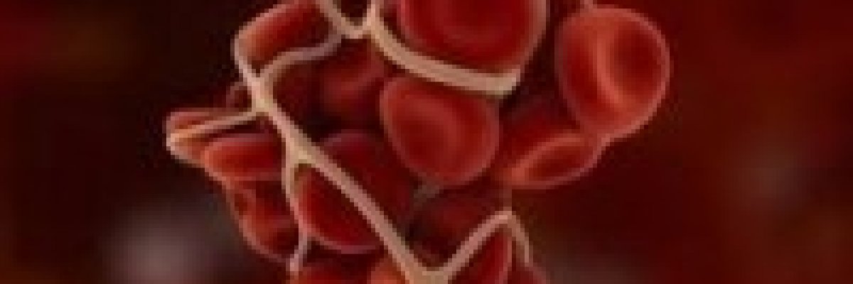 A véralvadásgátlók szedése valóban rendszeres felügyeletet igényel, ellenkező esetben nagyon komoly gondokat is okozhat