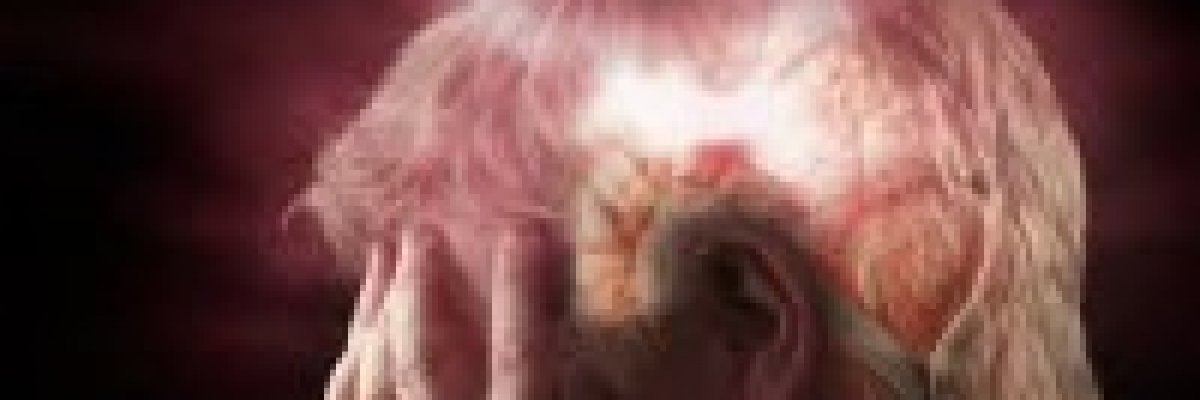 Kerülje el az újabb stroke-ot véralvadásgátló kezeléssel