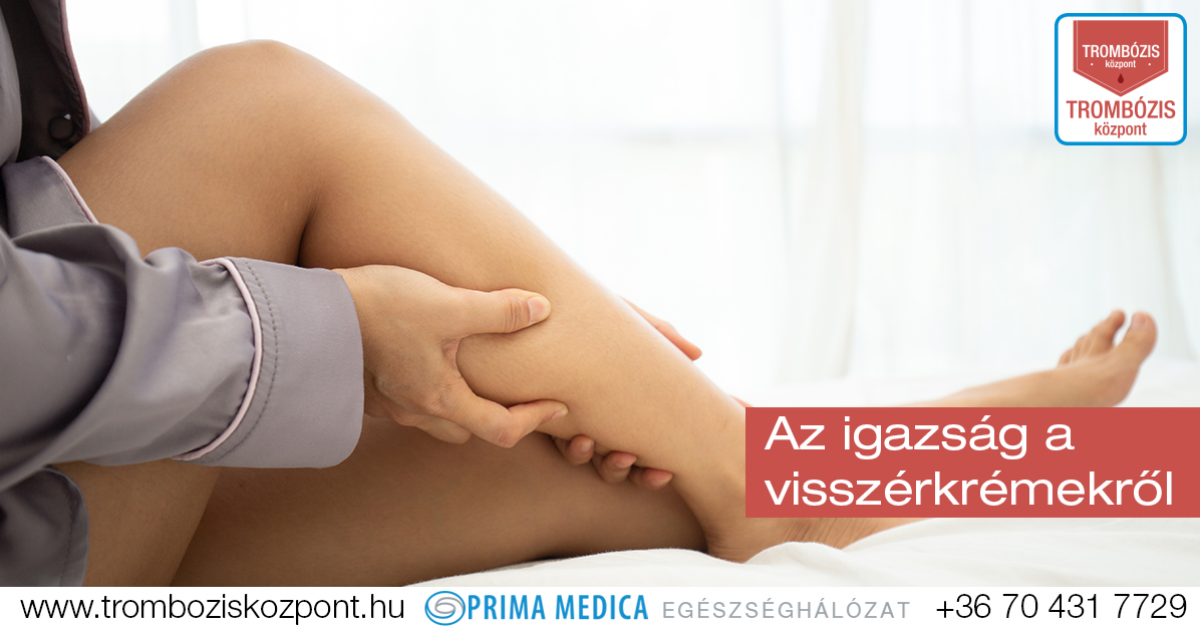 visszerek az életre veszélyesek