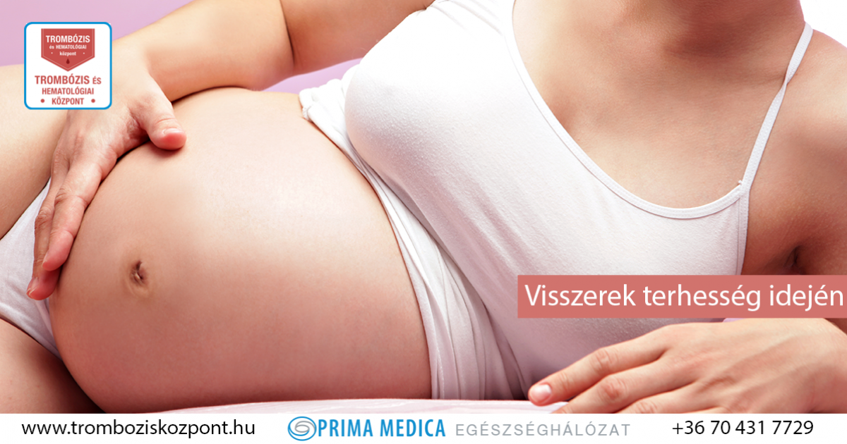 visszerek a terhesség alatt a kis medencében