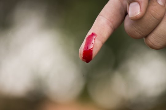 A véralvadásgátlót szedők legnagyobb félelme- vérzésveszély