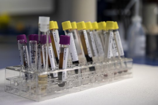 Mit jelez, ha csillagos a trombocitaszám a vérképemben?