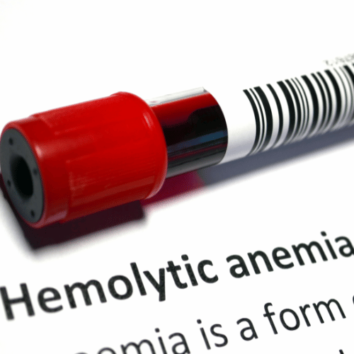 Autoimmun hemolitikus anémia - Trombózis- és Hematológiai Központ