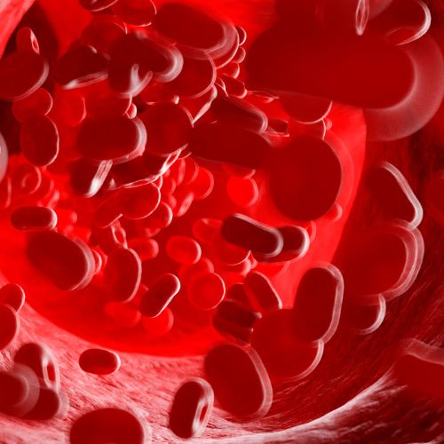 Trombózis a fiataloknál is kialakulhat, aminek oka lehet genetikai probléma is - Trombózis-, és Hematológiai Központ