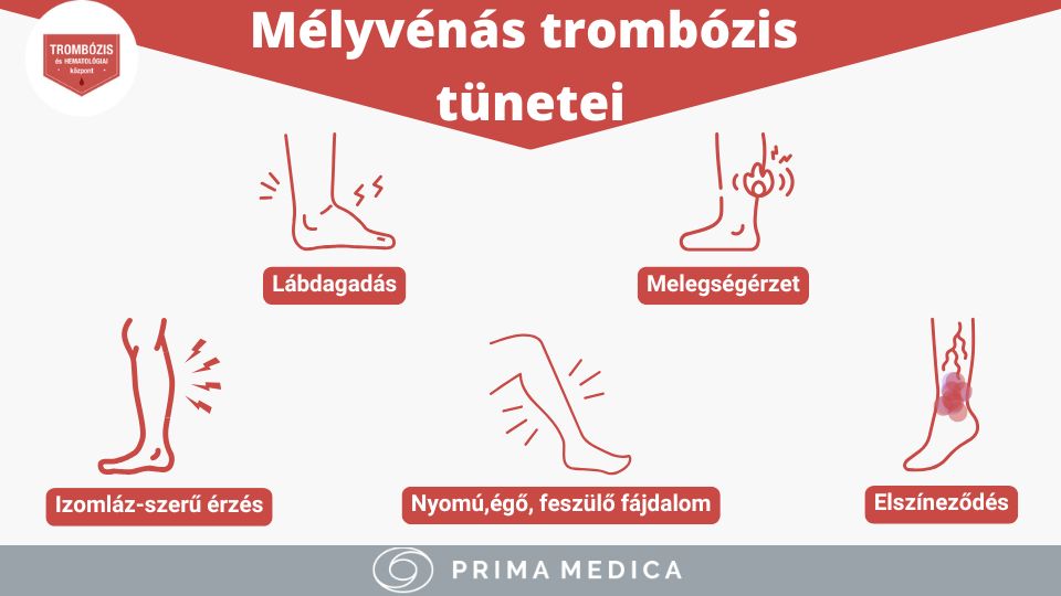 Trombózis tünetei - Trombózis-, és Hematológiai Központ