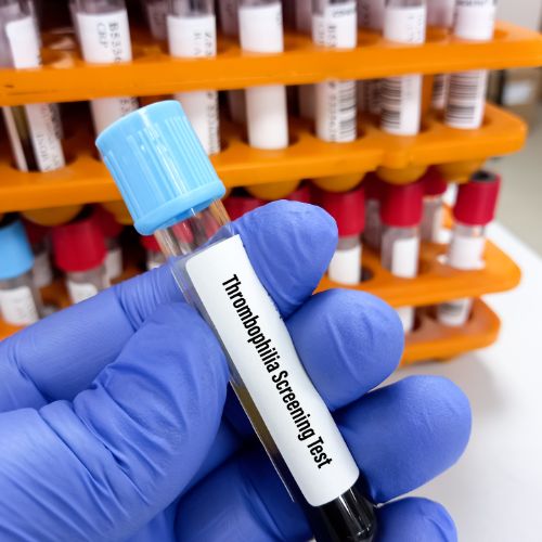 Utazás és trombózis - Trombózis-, és Hematológiai Központ