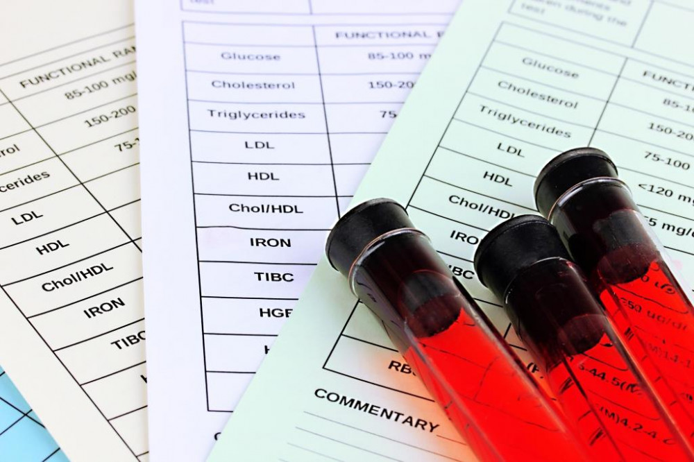 Laborvizsgálattal kimutatható a B12 vitaminhiány.